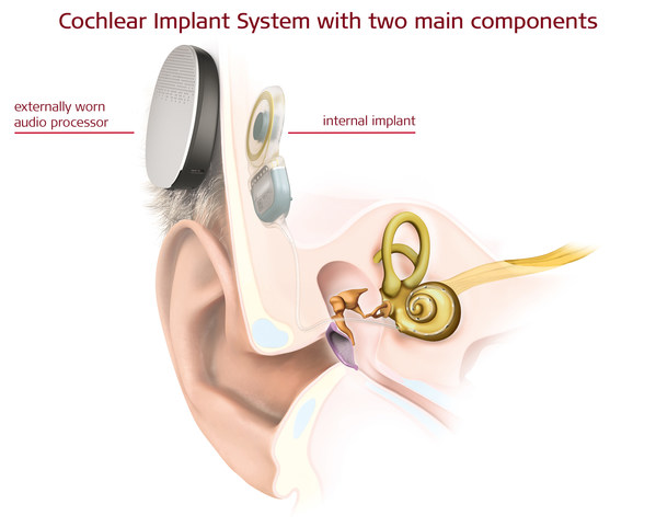 //mma.nyhomeapp.cn/media2/1314553/ear_anatomy.jpg?p=medium600