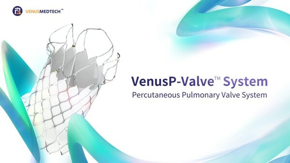 啟明醫療VenusP-Valve在美獲批臨床，創造中國瓣膜出海歷史